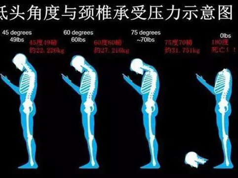 頸椎病、頸椎病、我用這些方法治頸椎